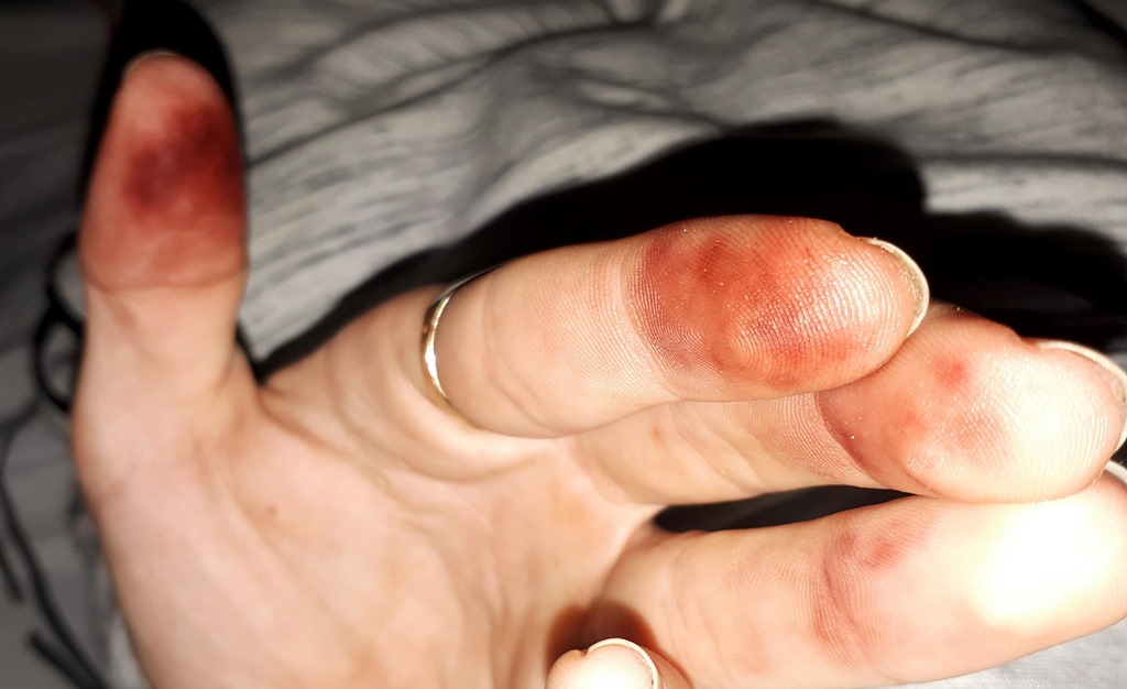 Main apres avoir manipule des iules